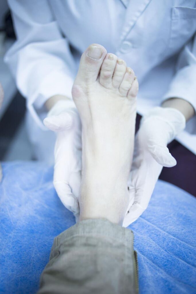 Clinician examining a patient's foot and bunion at the big toe joint